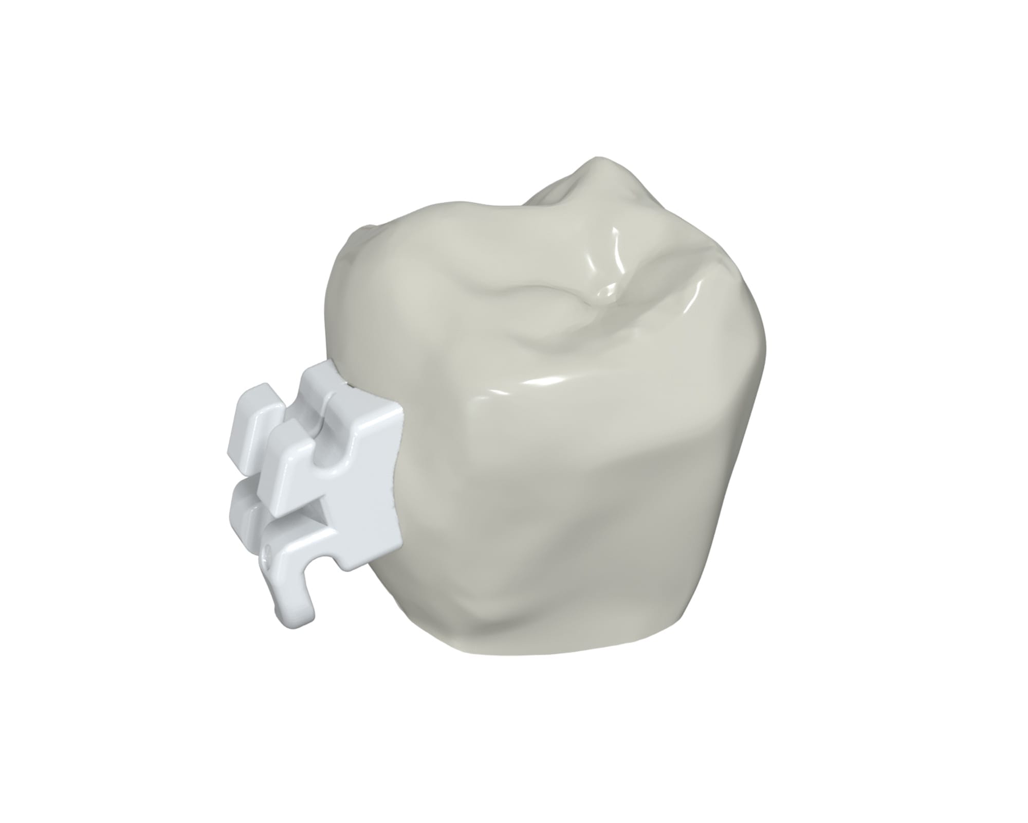 LightForce Braces use 3D printed brackets that are customized to fit your unique tooth shape and blend in with your smile.