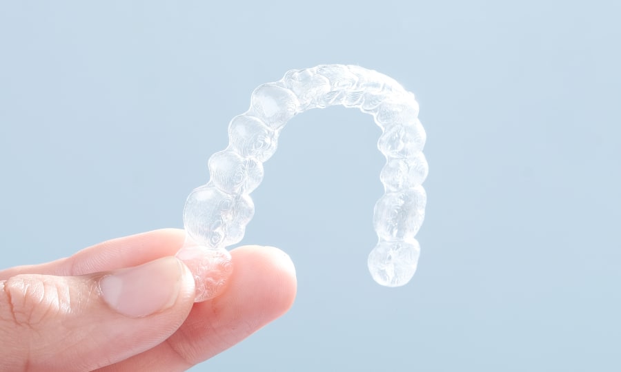 Smooth Construction of Clear Aligners at Waldman Orthodontics