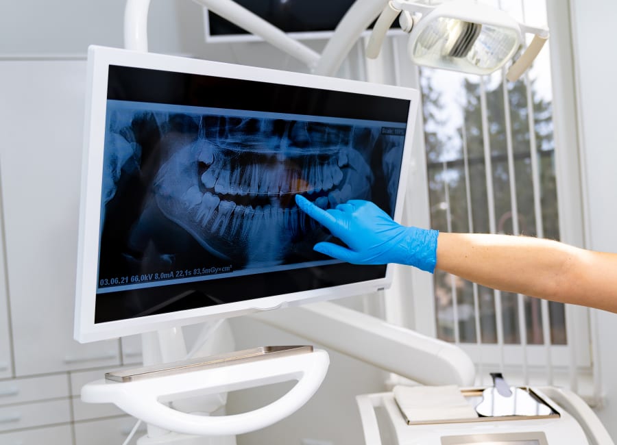 A dentist points to a panoramic X-ray.
