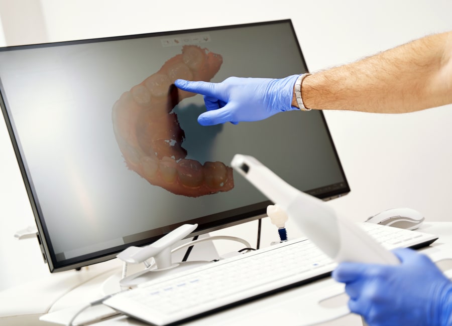 A dentist points at a screen of a digital rendering of the patient's teeth.